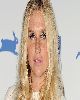 3 - Kesha