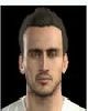 35 - Torosidis